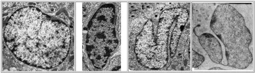 Diferentes formas del núcleo celular