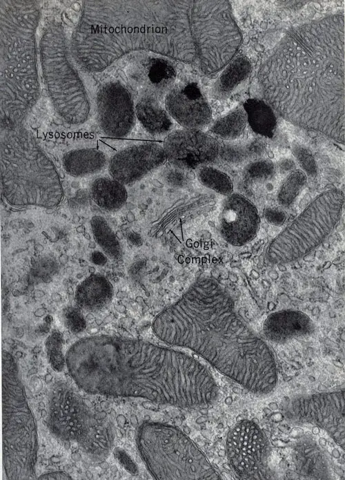 Lisosomas vistos al microscopio electrónico