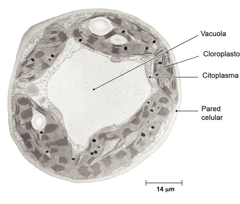 Imagen de microscopio electrónico de una vacuola, mostrando el gran espacio que ocupa en la célula, en comparación con otros orgánulos